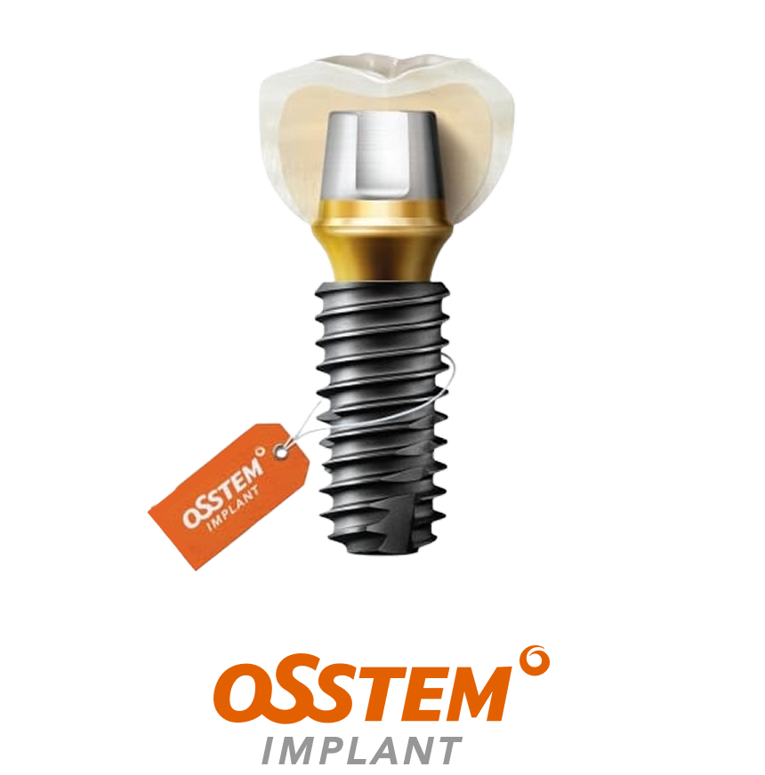 임플란트라인업